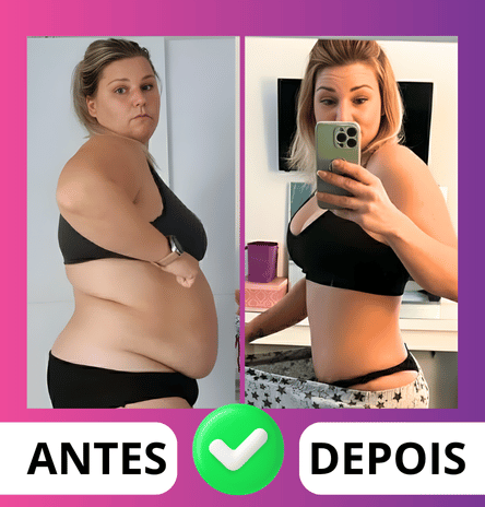 ANTES (10)